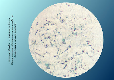 اطلس الميكروبيولوجي -1- 12_Diphtheria_Methylene+blue