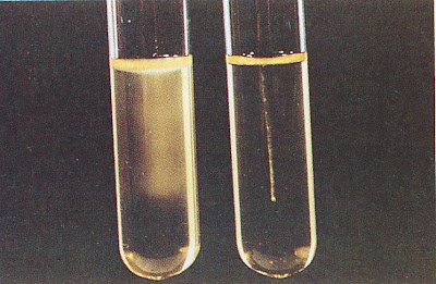 اطلس الميكروبيولوجي -1- Motility+Test