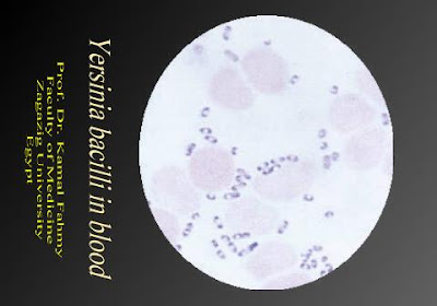 اطلس الميكروبيولوجي -1- Yersinia+in+blood2