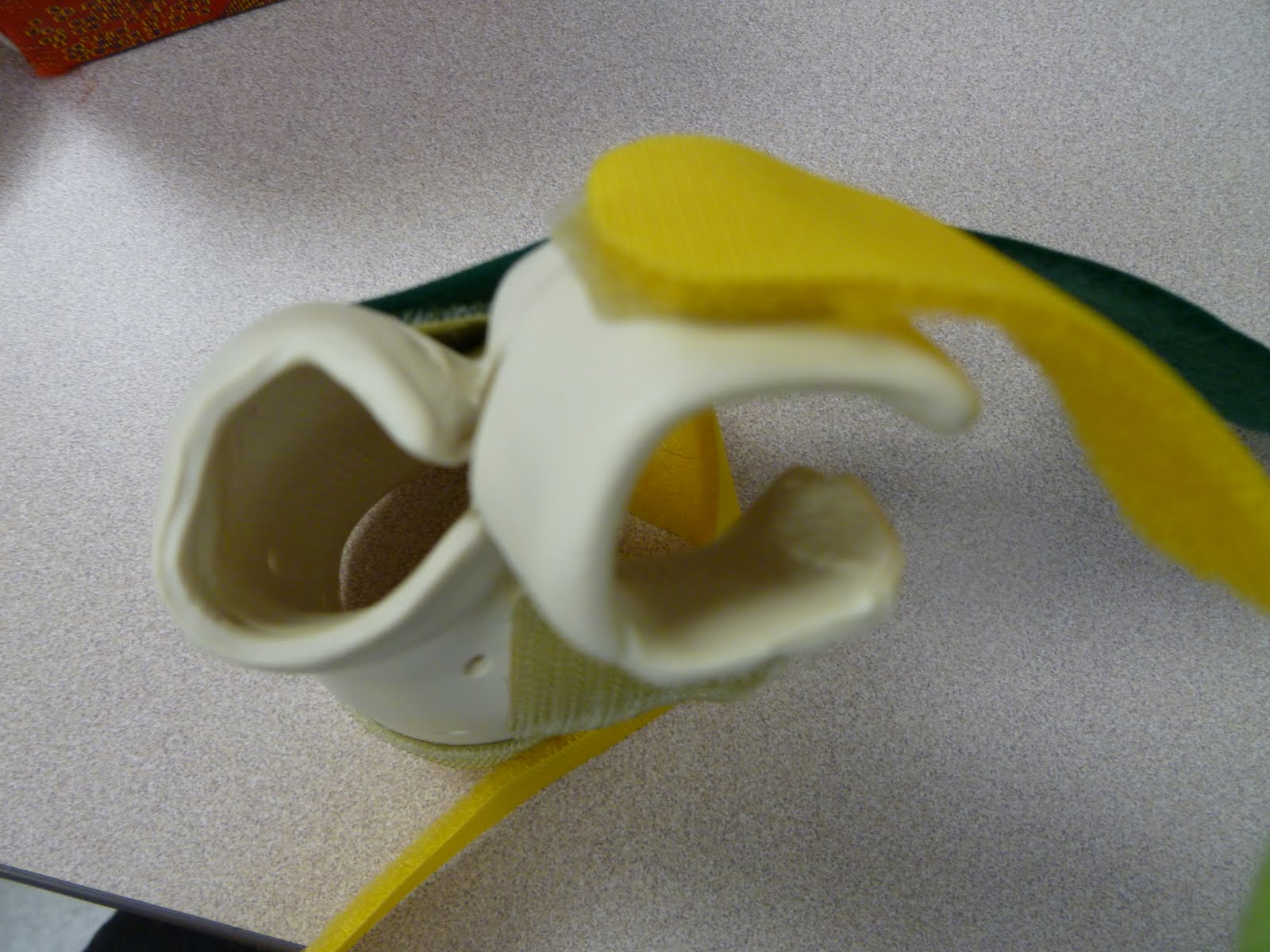 Adventures in Splinting DIP Blocking Exercise Splint