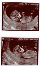 Baby Jakubik 12 weeks