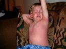 Allergic+hives+in+children
