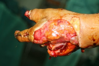 Mangled Hand
