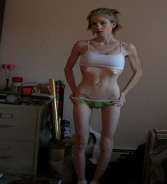 [chica%20anorexica.jpg]