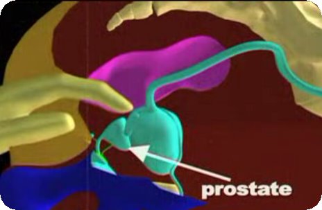 [Prst.bmp]