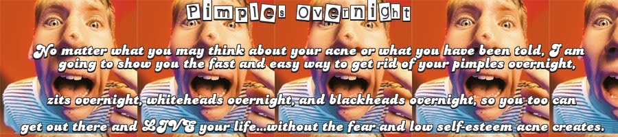 Pimples Overnight