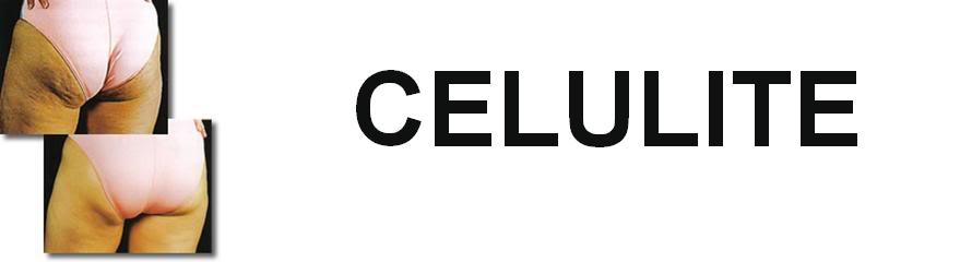 Celulite