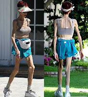 Holy Anorexia