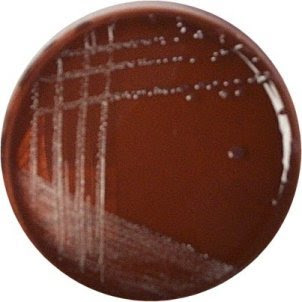 Shigella Macconkey