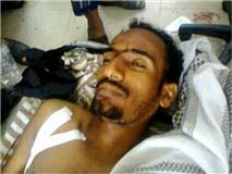 الشهيد عباس محمد صالح المحلئي احد ضحايا نظام صنعاء الإرهابي
