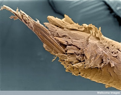15 imágenes microscópicas del cuerpo humano. 2.+Split+end+of+human+hair