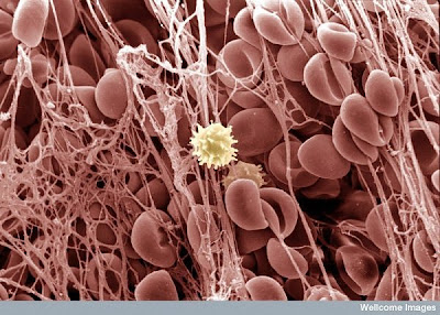 15 imágenes microscópicas del cuerpo humano. 8.+Blood+clot
