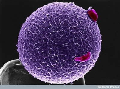 15 imágenes microscópicas del cuerpo humano. 12.+Human+egg+with+coronal+cells