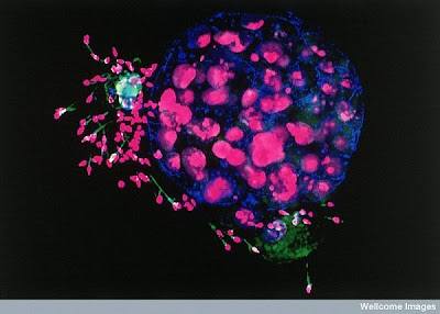 15 imágenes microscópicas del cuerpo humano. 14.+Human+embryo+and+sperm.