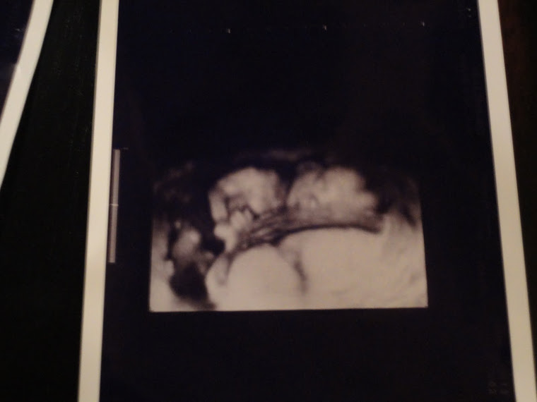 Ultrasound #4 (4D)