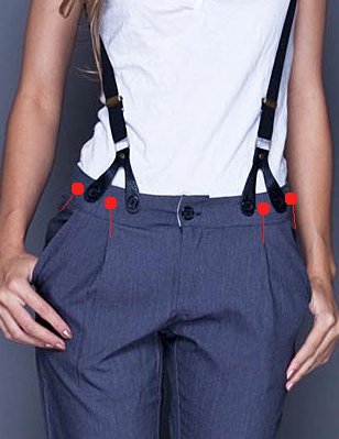 Everything About Braces: Placement of Brace Buttons