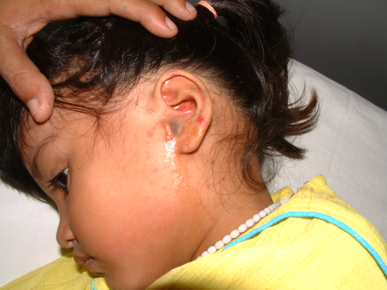 Ear infection nasal spray 800mg
