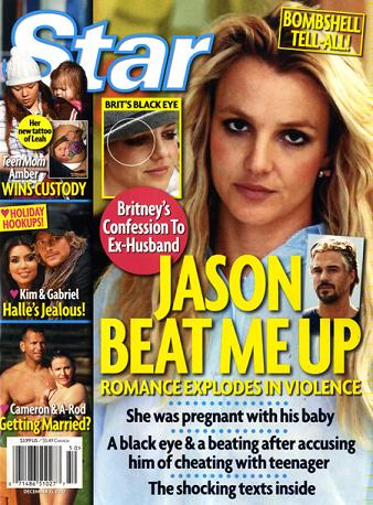 Dirt Did Britney S Boyfriend Beat Her