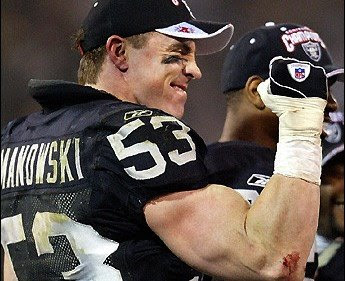 Nfl players that died from steroids