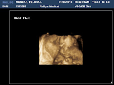 20 Week 3D ultrasound Picture!