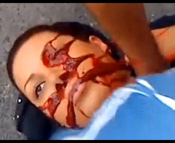 Coagulated Blood