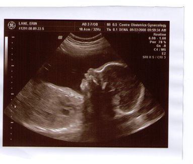 [Baby+Lane+28+weeks.jpg]