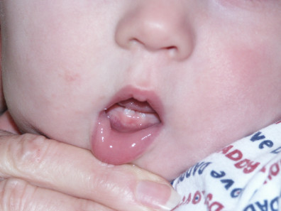 [FirstTeeth.JPG]