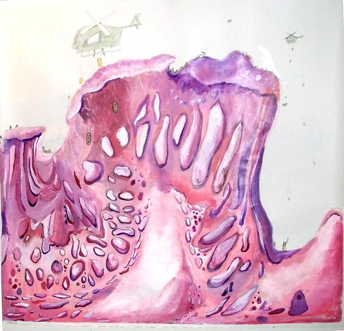 The War in my Intestines 2010.