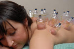 Try  Our New Cupping  Massage!