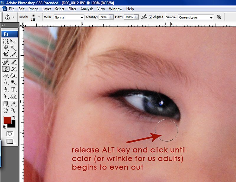 [21+click+til+undereye+gone.JPG]