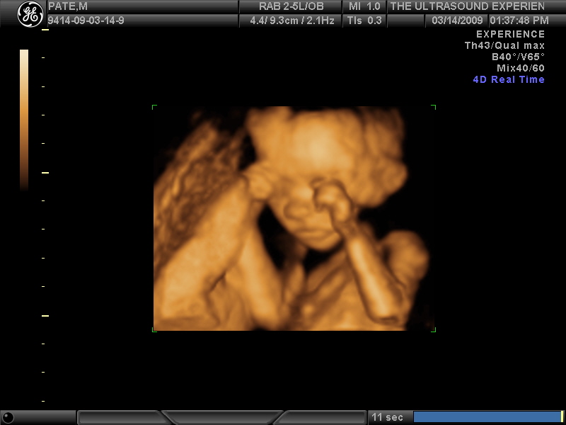 [OUR+BABY+GIRL+AT+20+WEEKS_9.JPG]