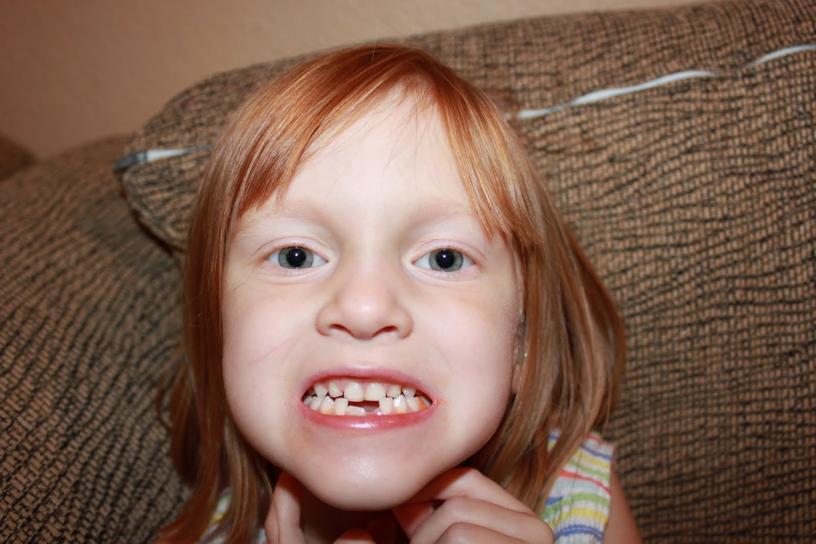Fallen Tooth