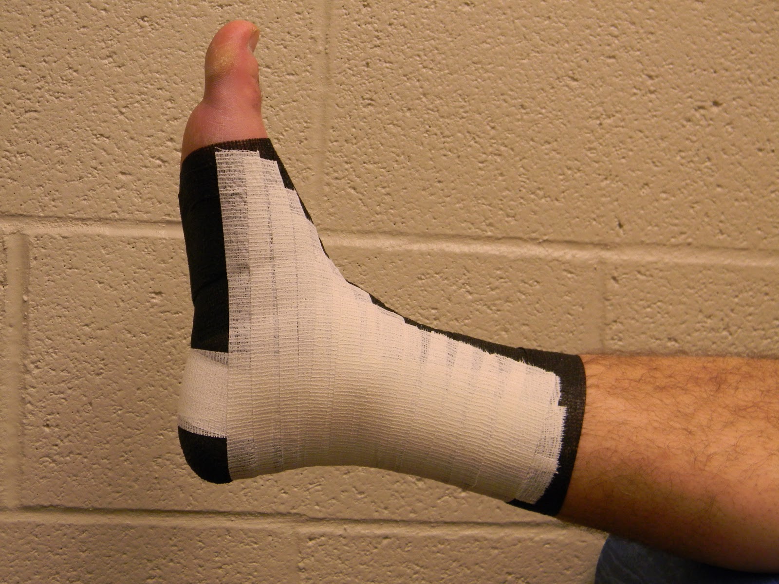 Athletic Training Open Basketweave