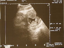 12 week ultrasound