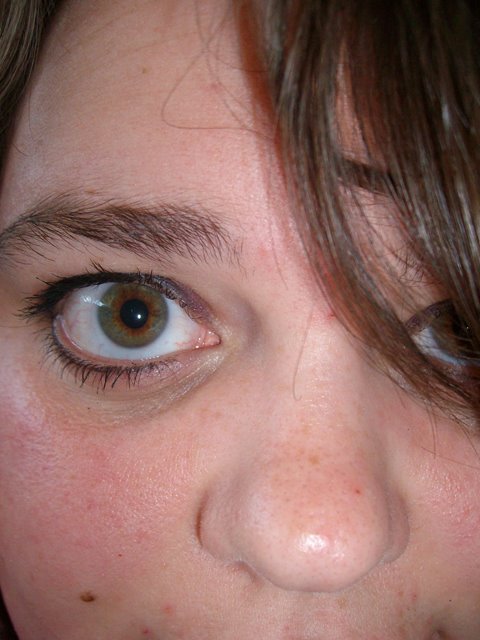 [Amanda's+Eye+07-08.JPG]