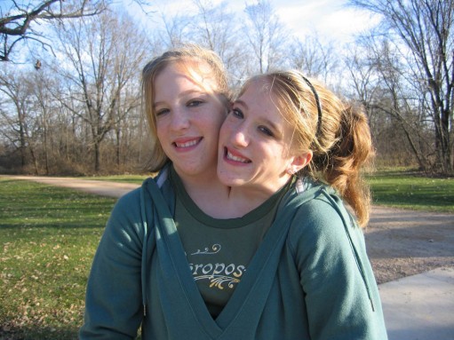 Фото Сестры Эбигейл и Бриттани Хенсел