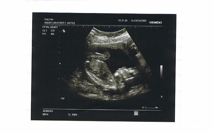 It's a GIRL!