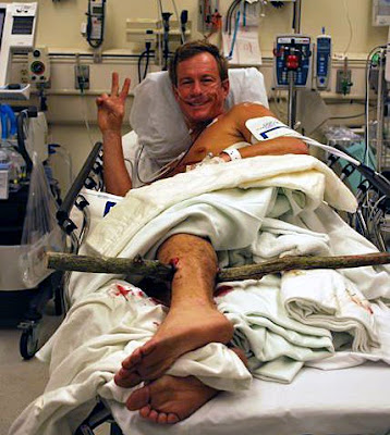 BOB'S FREAK CYCLING ACCIDENT :