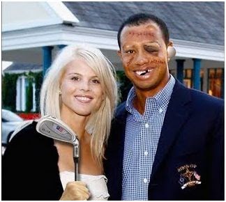 Boosheet Today: Report: Tiger Woods Had Plastic Surgery After Elin