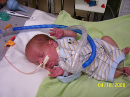 Braden