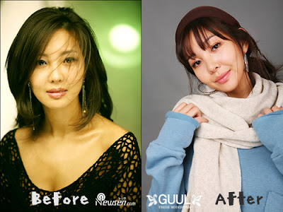 Kim Gyuri: Before and After
