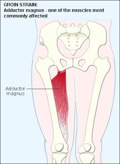Good Health Tips For you: Groin Strain Symptoms,Causes and Home remedies