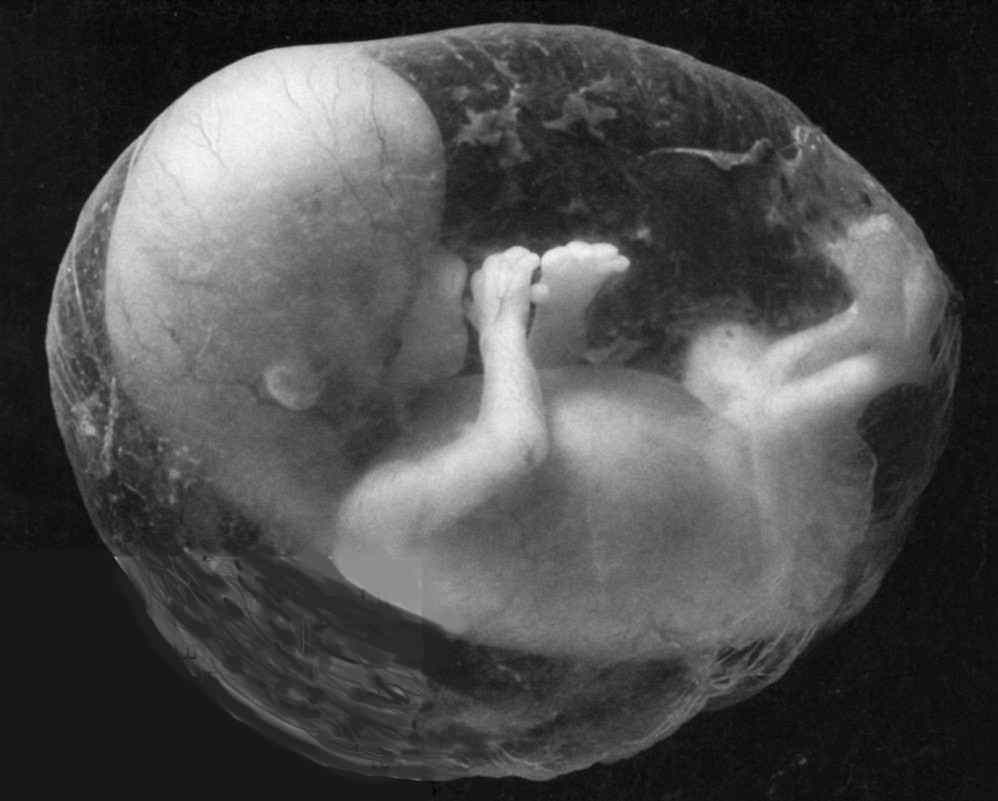 [Fetus2.jpg]