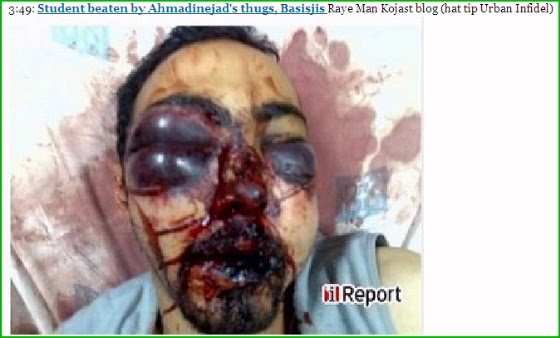 [IranianStudentBeaten560.jpg]
