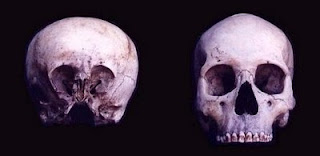 El cráneo de starchild: El niño de las estrellas Stardchild-craneo1