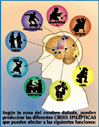 El curso de la profiláctica del alcoholismo