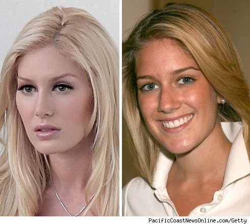 heidi montag plastic surgery 2010. Heidi Montag#39;s Plastic Surgery