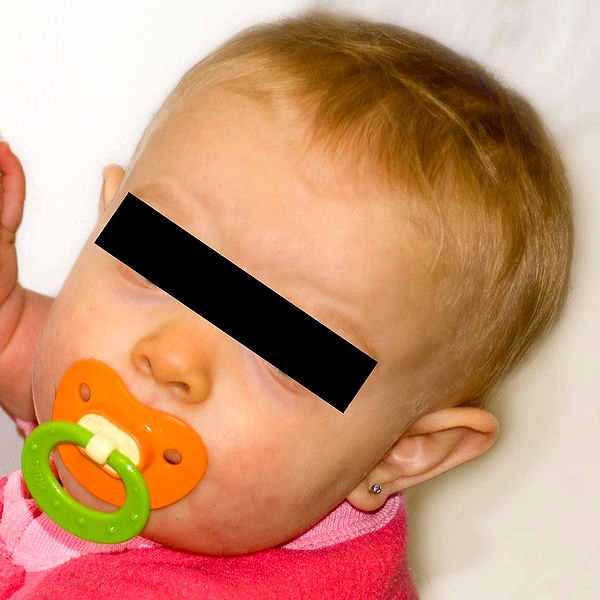 Yellow skin discoloration Causes of yellow skin color the dynamic