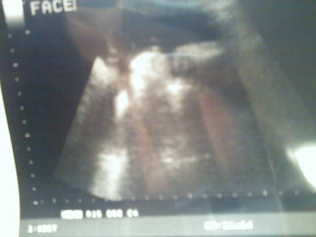[W37weeks.jpg]