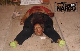 IMAGEN AUTOPSIA MUJER imagen autopsia mujer: